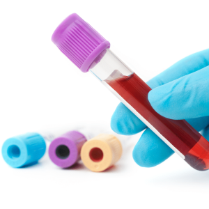 Blood Examination Blood Examination